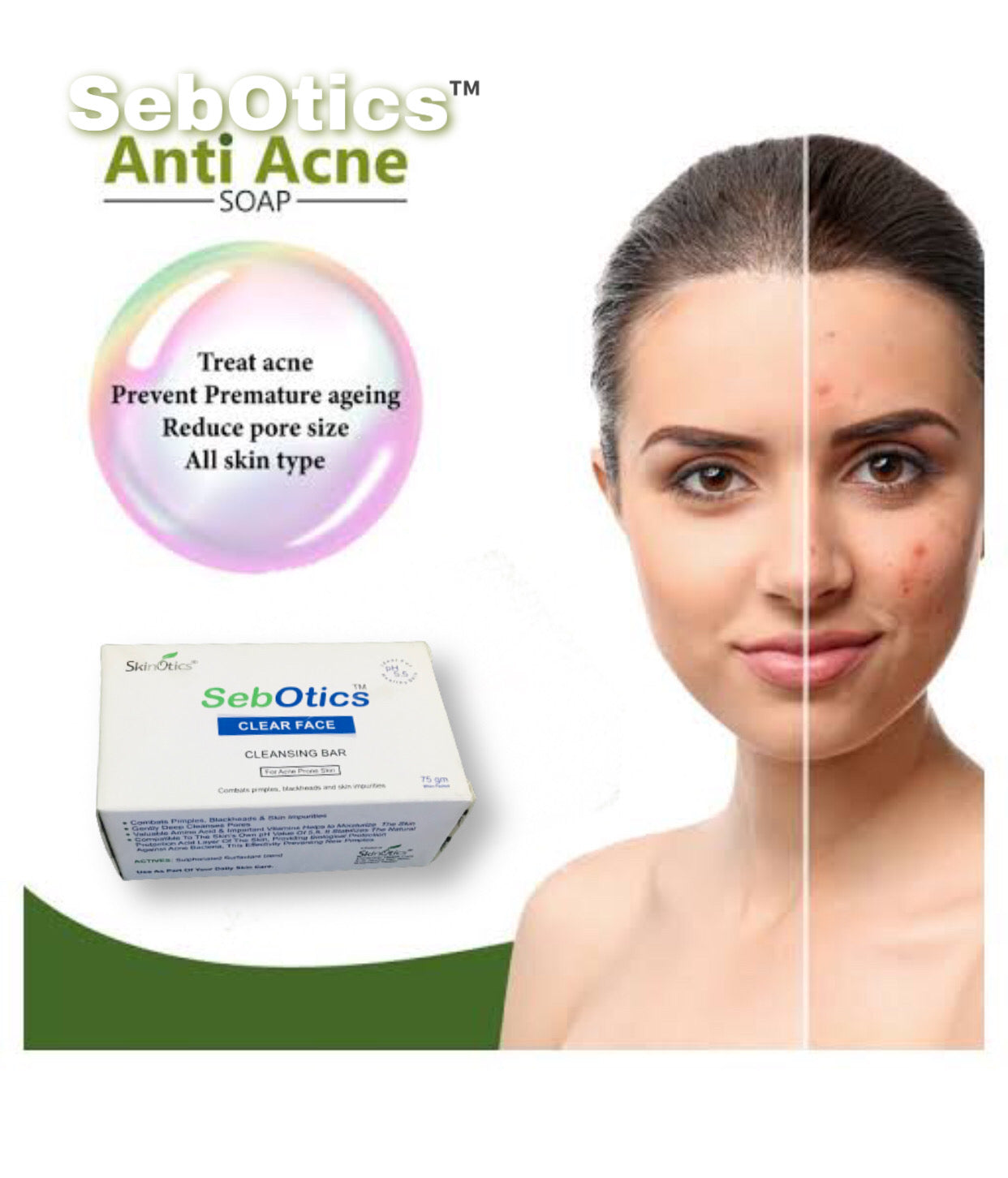 SebOtics Anti Acne Bar™️ 75g